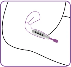 Elektrostymulacja mięśni Kegla