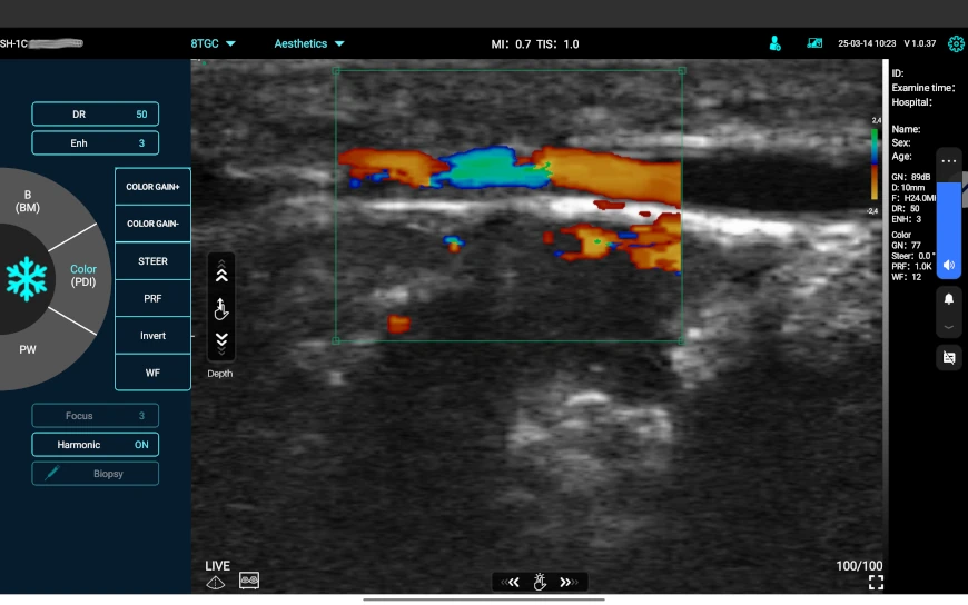 Ultrasonograf C10MR Pro - MyUSG