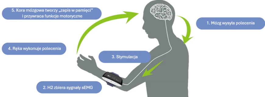 Biofeedback EMG ręki