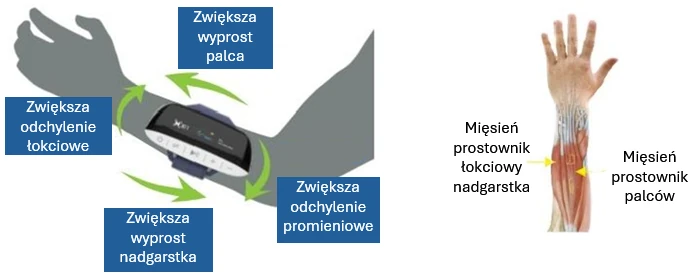 Ułożenie elektrod