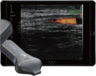System do ultrasonografii KONTED C10MR Pro w kosmetologii + SZKOLENIE