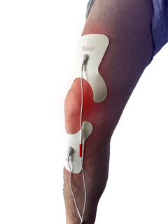 Elektrody Tenscare do elektrostymulacji stawu kolanowego