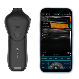 System do ultrasonografii KONTED C10MR Pro w kosmetologii + SZKOLENIE