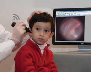 Wideootoskop cyfrowy FireFly DE-550 bezprzewodowy