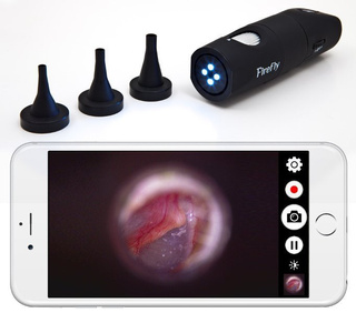 Wideootoskop cyfrowy FireFly DE-570 HD bezprzewodowy WiFi