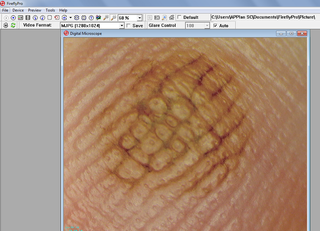 Wideodermatoskop cyfrowy FireFly DE-350 bezprzewodowy 0.35 MPx