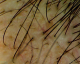 Wideodermatoskop cyfrowy FireFly DE-350 bezprzewodowy 0.35 MPx